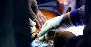 he-got-a-pig-kidney-transplant.-now-doctors-need-to-keep-it-working