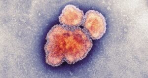 cdc-links-84%-of-measles-cases-in-chicago-to-illegal-aliens-from-venezuela
