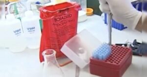 texas-man-hospitalized-with-anthrax-after-eating-contaminated-meat